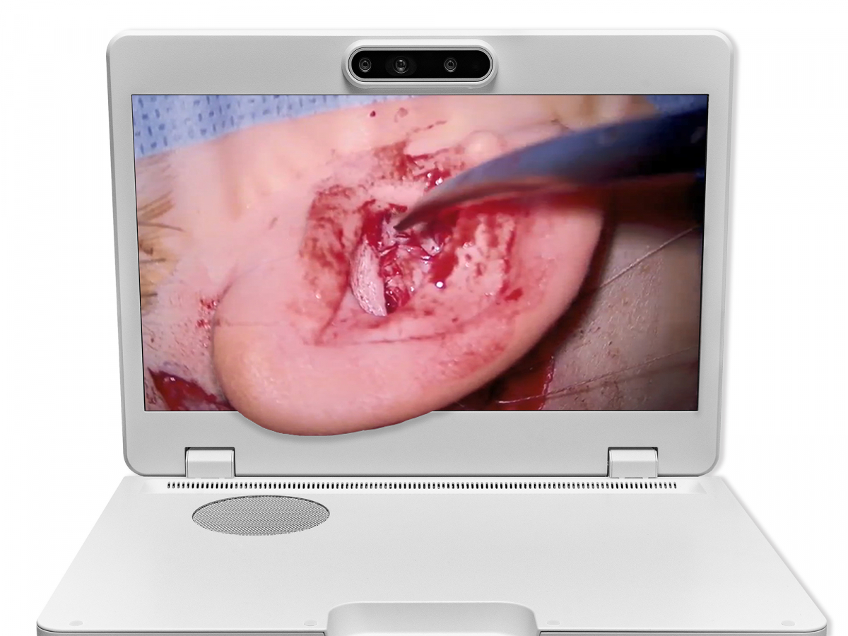 达擎之＂Heads-up 3D显微手术显示系统＂，整合4K裸眼3D显示及眼球追踪系统，具备快速追踪人眼移动位置功能，减轻医师长时间维持固定姿势的负担，让医师能有更宽广清晰的3D立体视野及更舒适的姿势来执行手术。